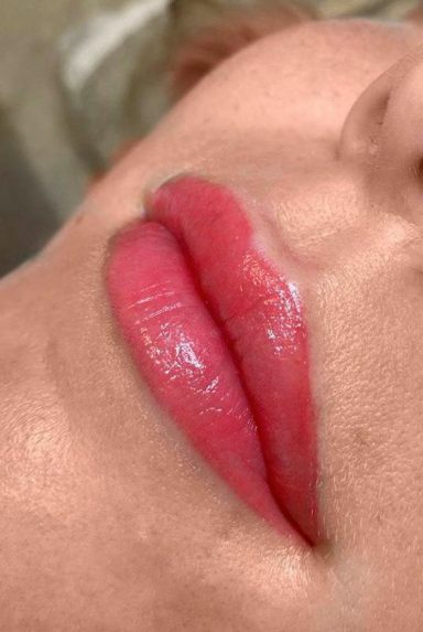 Lippen cliënt C na PMU
