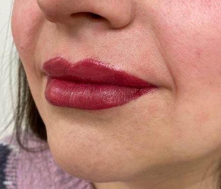 Lippen cliënt D na PMU